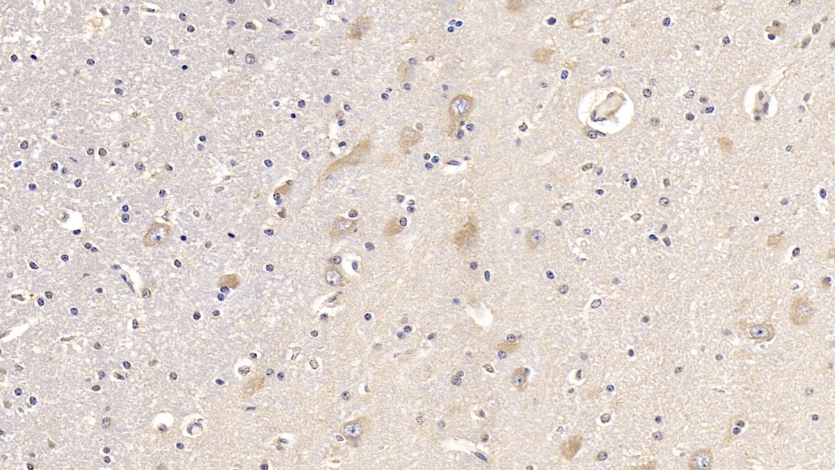 Immunohistochemistry-Paraffin: FGF-13 Antibody (C4) [NBP3-41909] - DAB staining on IHC-P; Sample: Human Cerebrum Tissue; Primary Ab: 10ug/ml NBP3-41909; Second Ab: 2ug/mL HRP-Linked Caprine Anti-Mouse IgG Polyclonal Antibody