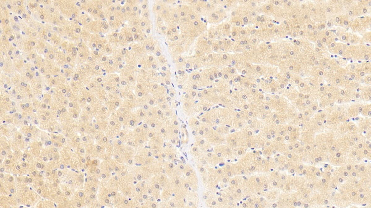 Immunohistochemistry-Paraffin OAS1 Antibody (C1)