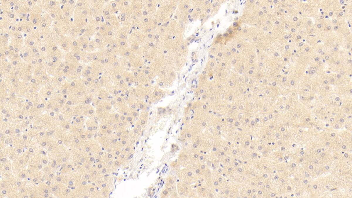 Immunohistochemistry-Paraffin OAS1 Antibody (C12)