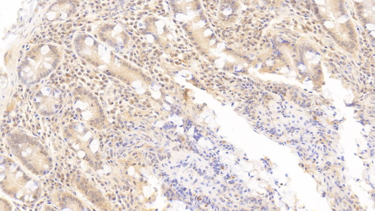 Immunohistochemistry-Paraffin OAS1 Antibody (C12)