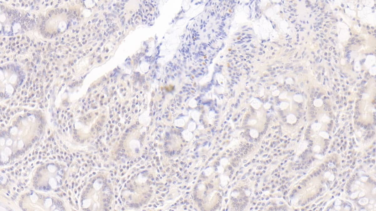 Immunohistochemistry-Paraffin OAS1 Antibody (C14)