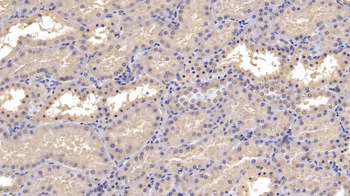 Immunohistochemistry-Paraffin: SLC12A3 Antibody (C4) [NBP3-41913] - DAB staining on IHC-P; Sample: Human Kidney Tissue; Primary Ab: 10ug/ml NBP3-41913; Second Ab: 2ug/mL HRP-Linked Caprine Anti-Mouse IgG Polyclonal Antibody