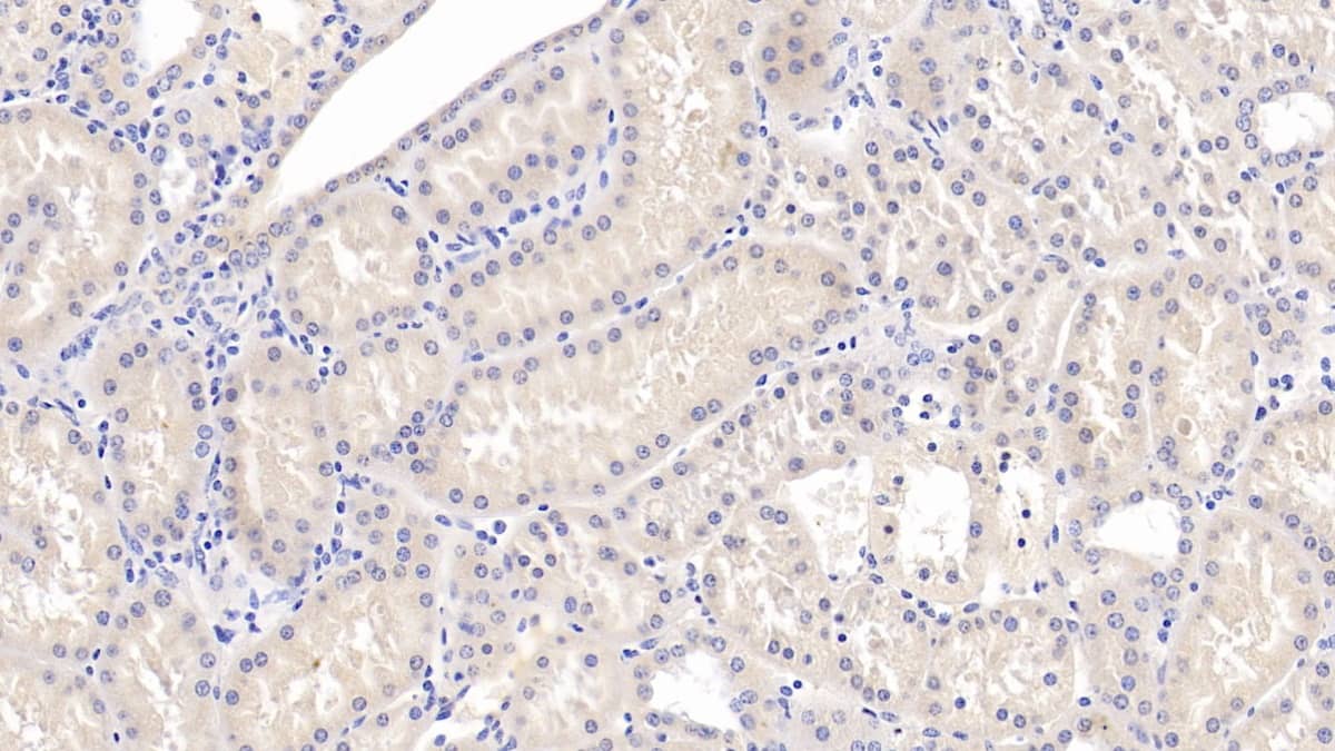 Immunohistochemistry-Paraffin: SLC12A3 Antibody (C5) [NBP3-41914] - DAB staining on IHC-P; Sample: Human Kidney Tissue; Primary Ab: 30ug/ml NBP3-41914; Second Ab: 2ug/mL HRP-Linked Caprine Anti-Mouse IgG Polyclonal Antibody