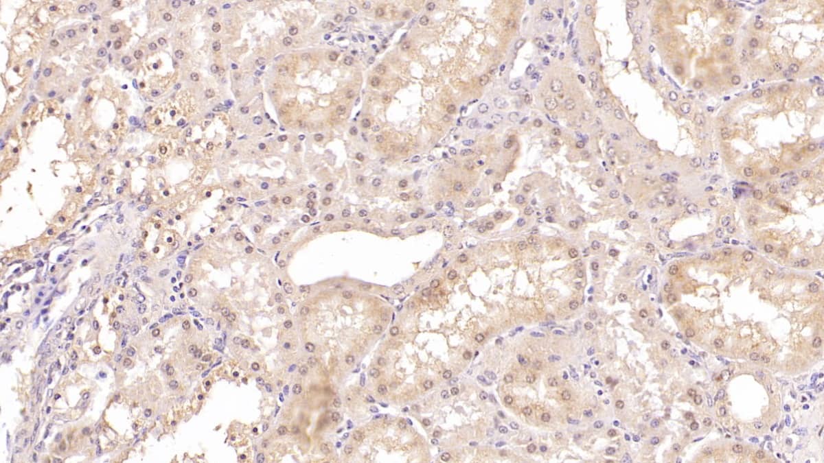 Immunohistochemistry-Paraffin: SLC12A3 Antibody (C7) [NBP3-41915] - DAB staining on IHC-P; Sample: Human Kidney Tissue; Primary Ab: 40ug/ml NBP3-41915; Second Ab: 2ug/mL HRP-Linked Caprine Anti-Mouse IgG Polyclonal Antibody