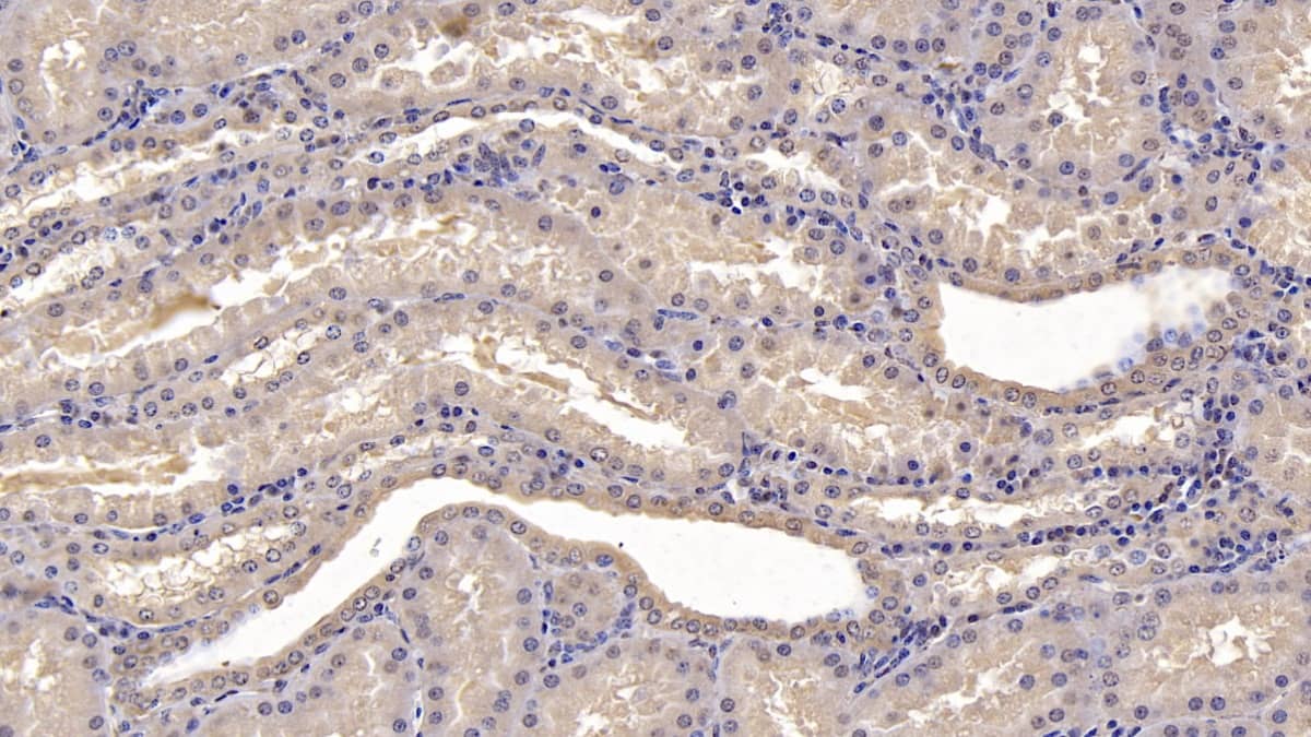 Immunohistochemistry-Paraffin: SLC12A3 Antibody (C9) [NBP3-41916] - DAB staining on IHC-P; Sample: Human Kidney Tissue; Primary Ab: 10ug/ml NBP3-41916; Second Ab: 2ug/mL HRP-Linked Caprine Anti-Mouse IgG Polyclonal Antibody