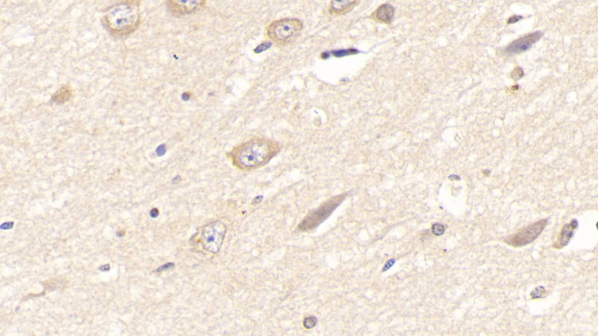 Immunohistochemistry-Paraffin: Laminin alpha 3 Antibody (C1) [NBP3-41917] - DAB staining on IHC-P; Sample: Human Cerebrum Tissue; Primary Ab: 20ug/ml NBP3-41917; Second Ab: 2ug/mL HRP-Linked Caprine Anti-Mouse IgG Polyclonal Antibody