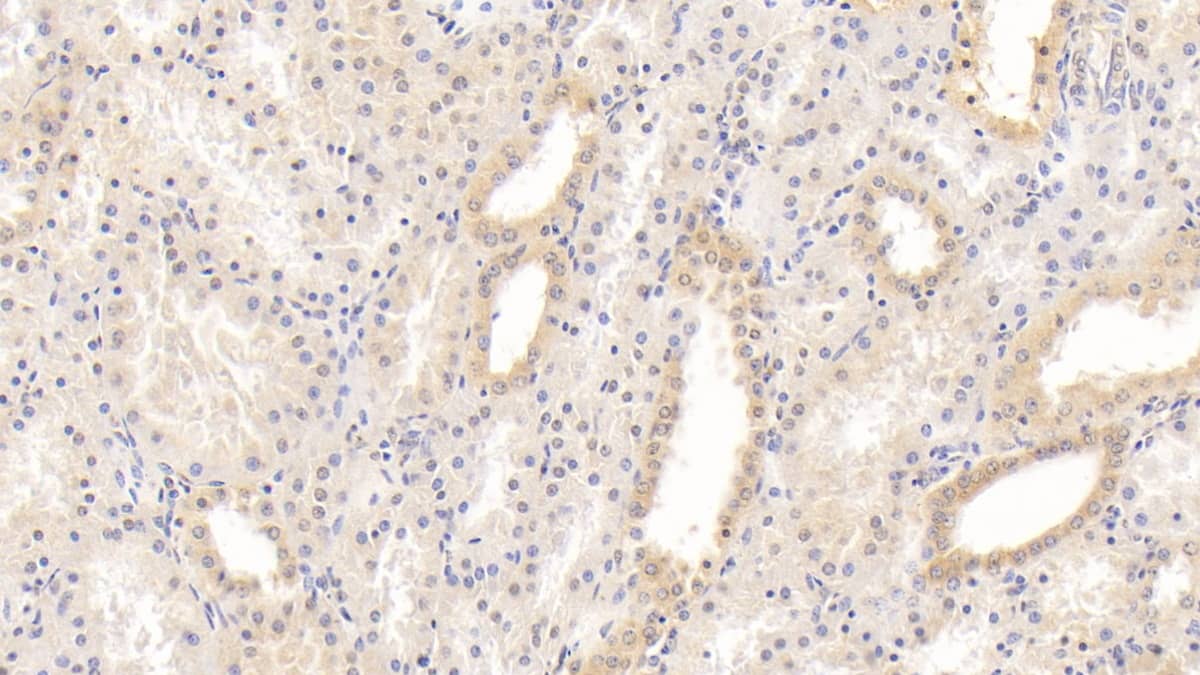 Immunohistochemistry-Paraffin: Laminin alpha 3 Antibody (C1) [NBP3-41917] - DAB staining on IHC-P; Sample: Human Kidney Tissue; Primary Ab: 20ug/ml NBP3-41917; Second Ab: 2ug/mL HRP-Linked Caprine Anti-Mouse IgG Polyclonal Antibody