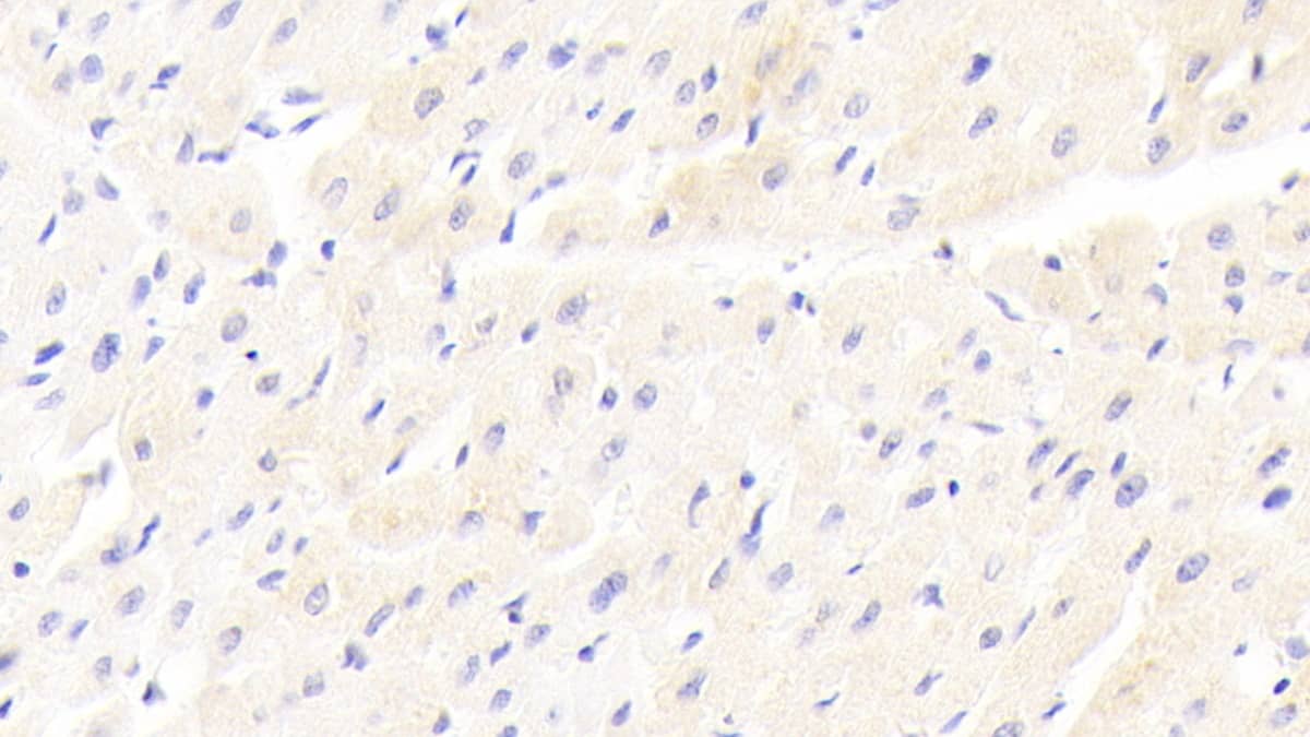 Immunohistochemistry-Paraffin: LRP-6 Antibody (C4) [NBP3-41918] - DAB staining on IHC-P; Sample: Human Cardiac Muscle Tissue; Primary Ab: 20ug/ml NBP3-41918; Second Ab: 2ug/mL HRP-Linked Caprine Anti-Mouse IgG Polyclonal Antibody