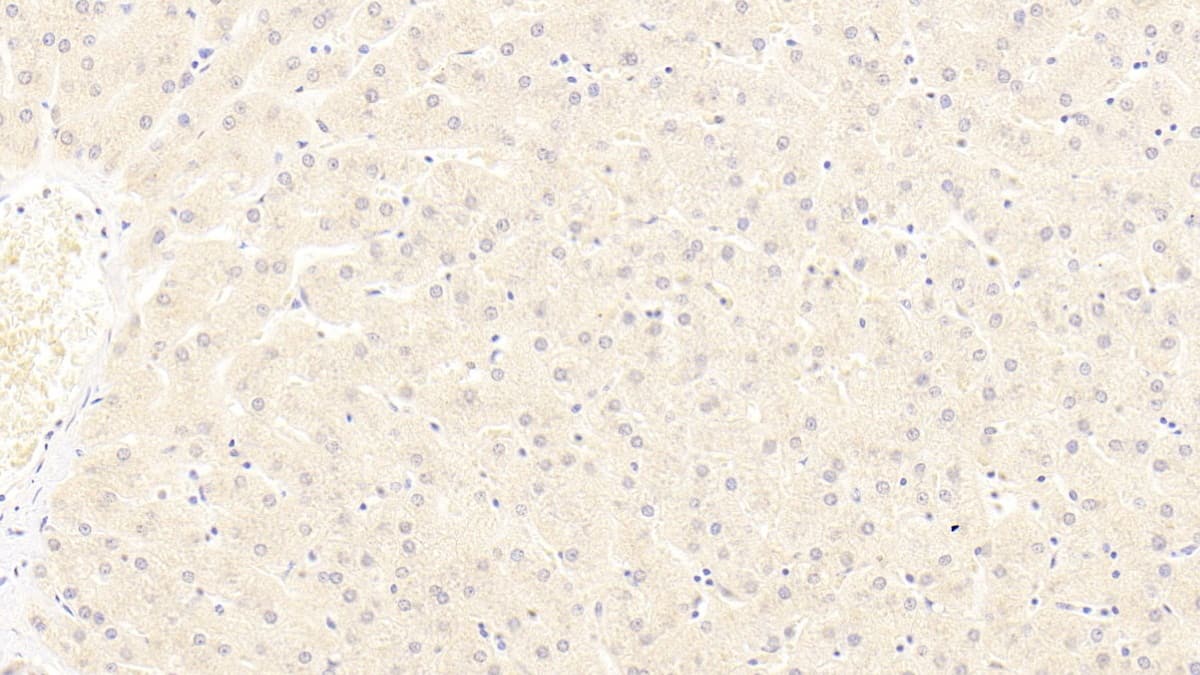 Immunohistochemistry-Paraffin: LRP-6 Antibody (C4) [NBP3-41918] - DAB staining on IHC-P; Sample: Human Liver Tissue; Primary Ab: 20ug/ml NBP3-41918; Second Ab: 2ug/mL HRP-Linked Caprine Anti-Mouse IgG Polyclonal Antibody