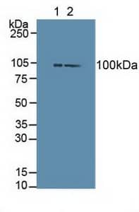 Western Blot: Dishevelled-3 Antibody [NBP3-41919] - Sample: Lane1: Mouse Brain Tissue; Lane2: Mouse Liver Tissue.