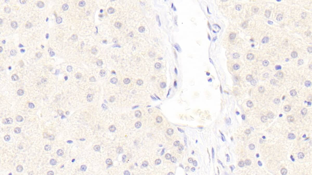 Immunohistochemistry-Paraffin: LRP-6 Antibody (C7) [NBP3-41920] - DAB staining on IHC-P; Sample: Human Liver Tissue; Primary Ab: 20ug/ml NBP3-41920; Second Ab: 2ug/mL HRP-Linked Caprine Anti-Mouse IgG Polyclonal Antibody