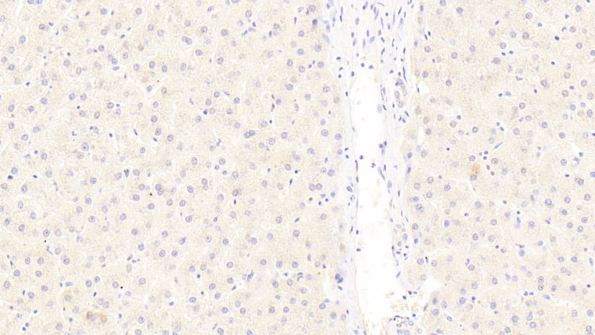 Immunohistochemistry-Paraffin: LRP-6 Antibody (C9) [NBP3-41921] - DAB staining on IHC-P; Sample: Human Liver Tissue; Primary Ab: 20ug/ml NBP3-41921; Second Ab: 2ug/mL HRP-Linked Caprine Anti-Mouse IgG Polyclonal Antibody