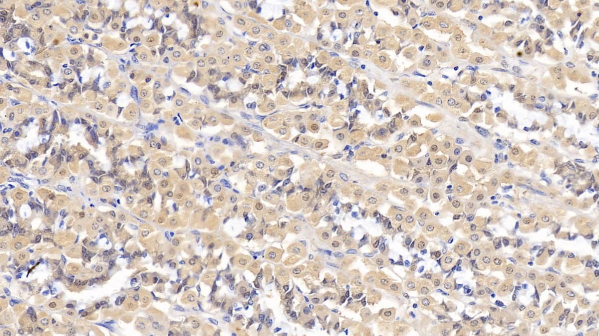 Immunohistochemistry-Paraffin: IFN-alpha F/IFNA21 Antibody (C7) [NBP3-41922] - DAB staining on IHC-P; Samples: Human Stomach Tissue; Primary Ab: 10ug/ml NBP3-41922; Second Ab: 2ug/mL HRP-Linked Caprine Anti-Mouse IgG Polyclonal Antibody