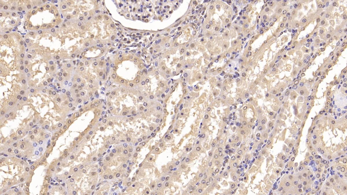 Immunohistochemistry-Paraffin: IFN-alpha F/IFNA21 Antibody (C1) [NBP3-41923] - DAB staining on IHC-P; Sample: Human Kidney Tissue; Primary Ab: 20ug/ml NBP3-41923; Second Ab: 2ug/mL HRP-Linked Caprine Anti-Mouse IgG Polyclonal Antibody
