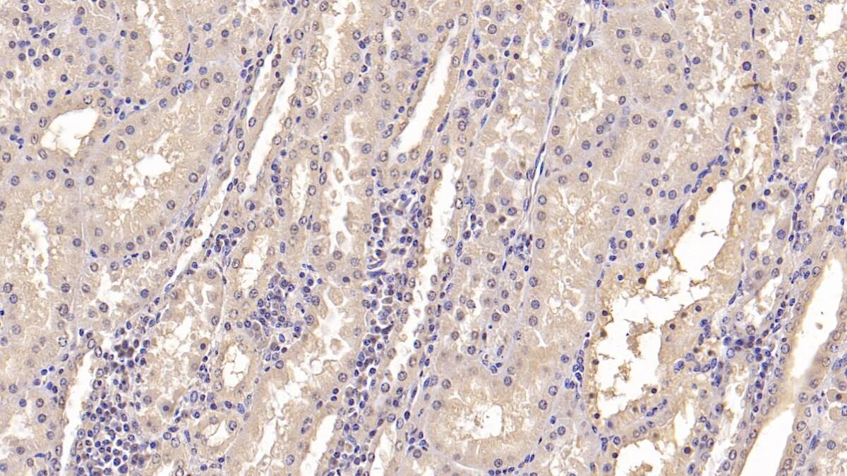 Immunohistochemistry-Paraffin: IFN-alpha F/IFNA21 Antibody (C2) [NBP3-41924] - DAB staining on IHC-P; Sample: Human Kidney Tissue; Primary Ab: 20ug/ml NBP3-41924; Second Ab: 2ug/mL HRP-Linked Caprine Anti-Mouse IgG Polyclonal Antibody