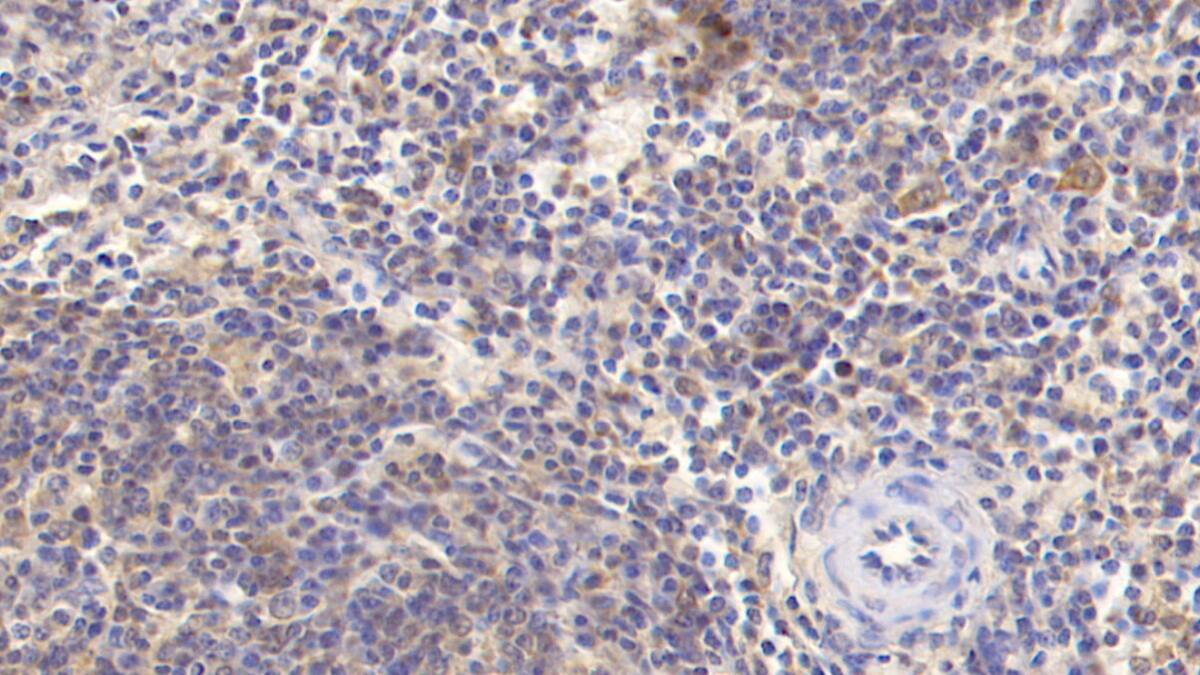 Immunohistochemistry-Paraffin: MAPRE1 Antibody (C5) [NBP3-41927] - DAB staining on IHC-P; Sample: Human Spleen Tissue; Primary Ab: 30ug/ml NBP3-41927; Second Ab: 2ug/mL HRP-Linked Caprine Anti-Mouse IgG Polyclonal Antibody