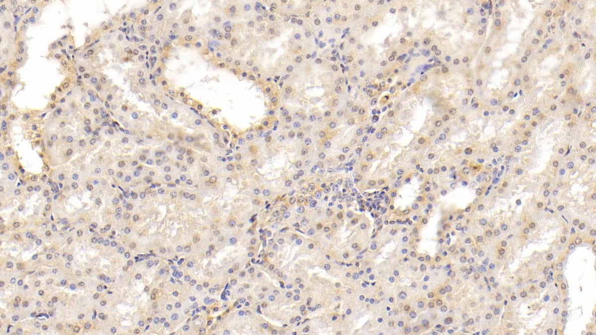 Immunohistochemistry-Paraffin: MAPRE1 Antibody (C5) [NBP3-41927] - DAB staining on IHC-P; Sample: Human Kidney Tissue; Primary Ab: 30ug/ml NBP3-41927; Second Ab: 2ug/mL HRP-Linked Caprine Anti-Mouse IgG Polyclonal Antibody