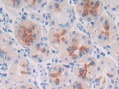 Immunohistochemistry-Paraffin MUC3B Antibody