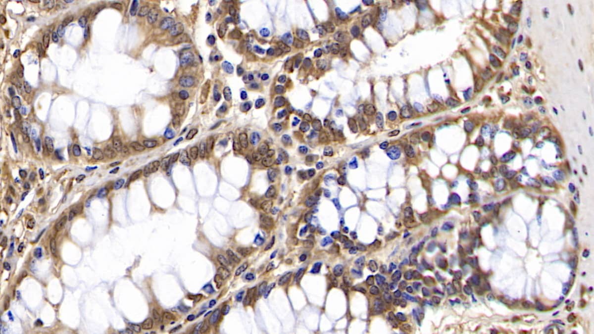 Immunohistochemistry-Paraffin OAS2 Antibody (C5)