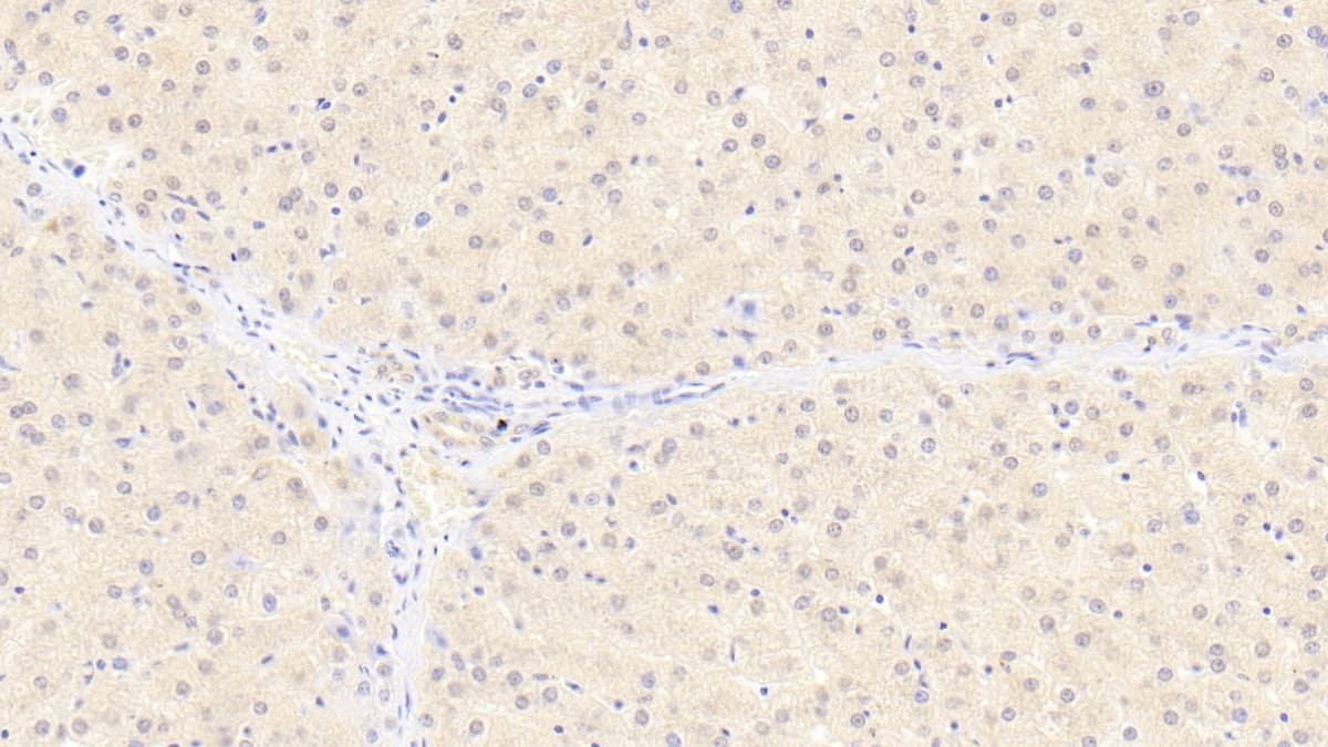 Immunohistochemistry-Paraffin: TTC11 Antibody (D3) [NBP3-41932] - DAB staining on IHC-P; Sample: Human Liver Tissue; Primary Ab: 20ug/ml NBP3-41932; Second Ab: 2ug/mL HRP-Linked Caprine Anti-Mouse IgG Polyclonal Antibody