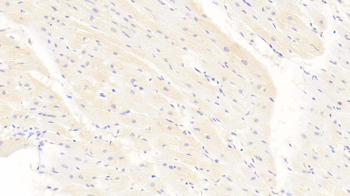 Immunohistochemistry-Paraffin: Calponin 2 Antibody (C15) [NBP3-41933] - DAB staining on IHC-P; Sample: Human Cardiac Muscle Tissue; Primary Ab: 10ug/ml NBP3-41933; Second Ab: 2ug/mL HRP-Linked Caprine Anti-Mouse IgG Polyclonal Antibody