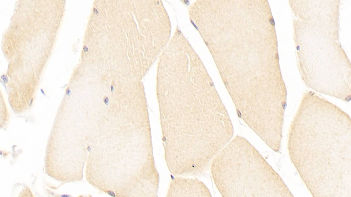 Immunohistochemistry-Paraffin: ISLR Antibody (C11) [NBP3-41934] - DAB staining on IHC-P; Sample: Human Skeletal muscle Tissue; Primary Ab: 20ug/ml NBP3-41934; Second Ab: 2ug/mL HRP-Linked Caprine Anti-Mouse IgG Polyclonal Antibody