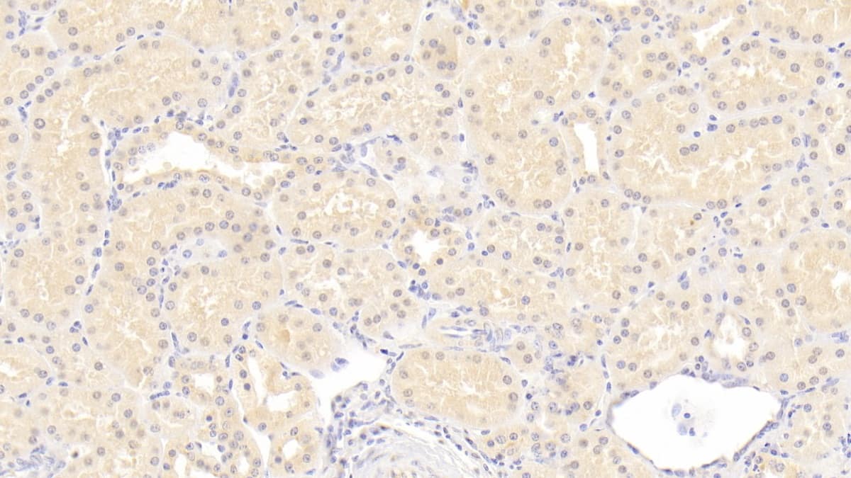 Immunohistochemistry-Paraffin: ISLR Antibody (C11) [NBP3-41934] - DAB staining on IHC-P; Sample: Human Kidney Tissue; Primary Ab: 20ug/ml NBP3-41934; Second Ab: 2ug/mL HRP-Linked Caprine Anti-Mouse IgG Polyclonal Antibody