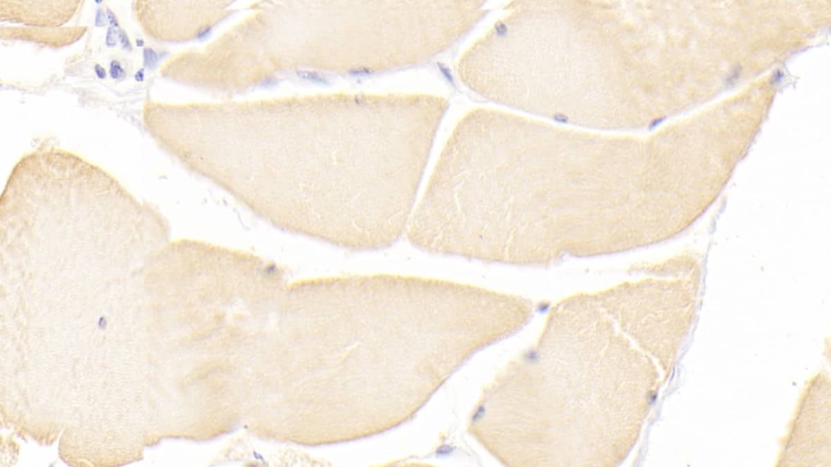 Immunohistochemistry-Paraffin: ISLR Antibody (C5) [NBP3-41935] - DAB staining on IHC-P; Sample: Human Skeletal muscle Tissue; Primary Ab: 20ug/ml NBP3-41935; Second Ab: 2ug/mL HRP-Linked Caprine Anti-Mouse IgG Polyclonal Antibody