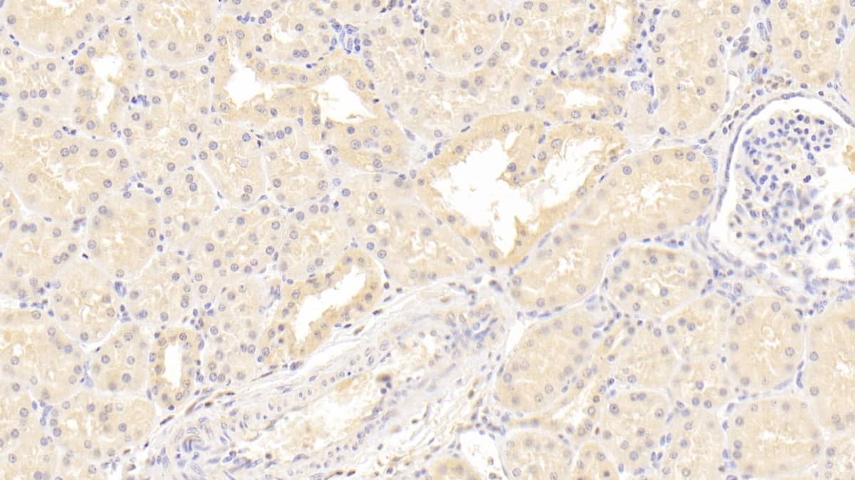 Immunohistochemistry-Paraffin: ISLR Antibody (C5) [NBP3-41935] - DAB staining on IHC-P; Sample: Human Kidney Tissue; Primary Ab: 20ug/ml NBP3-41935; Second Ab: 2ug/mL HRP-Linked Caprine Anti-Mouse IgG Polyclonal Antibody