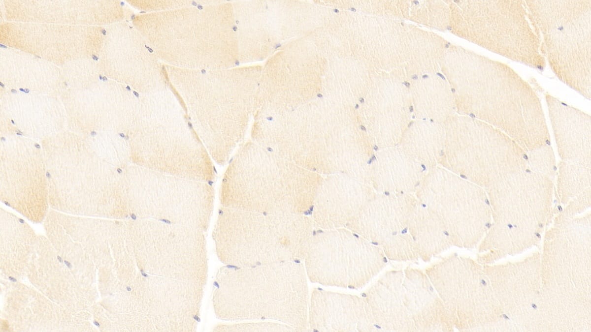 Immunohistochemistry-Paraffin: ISLR Antibody (C9) [NBP3-41936] - DAB staining on IHC-P; Sample: Human Skeletal muscle Tissue; Primary Ab: 20ug/ml NBP3-41936; Second Ab: 2ug/mL HRP-Linked Caprine Anti-Mouse IgG Polyclonal Antibody