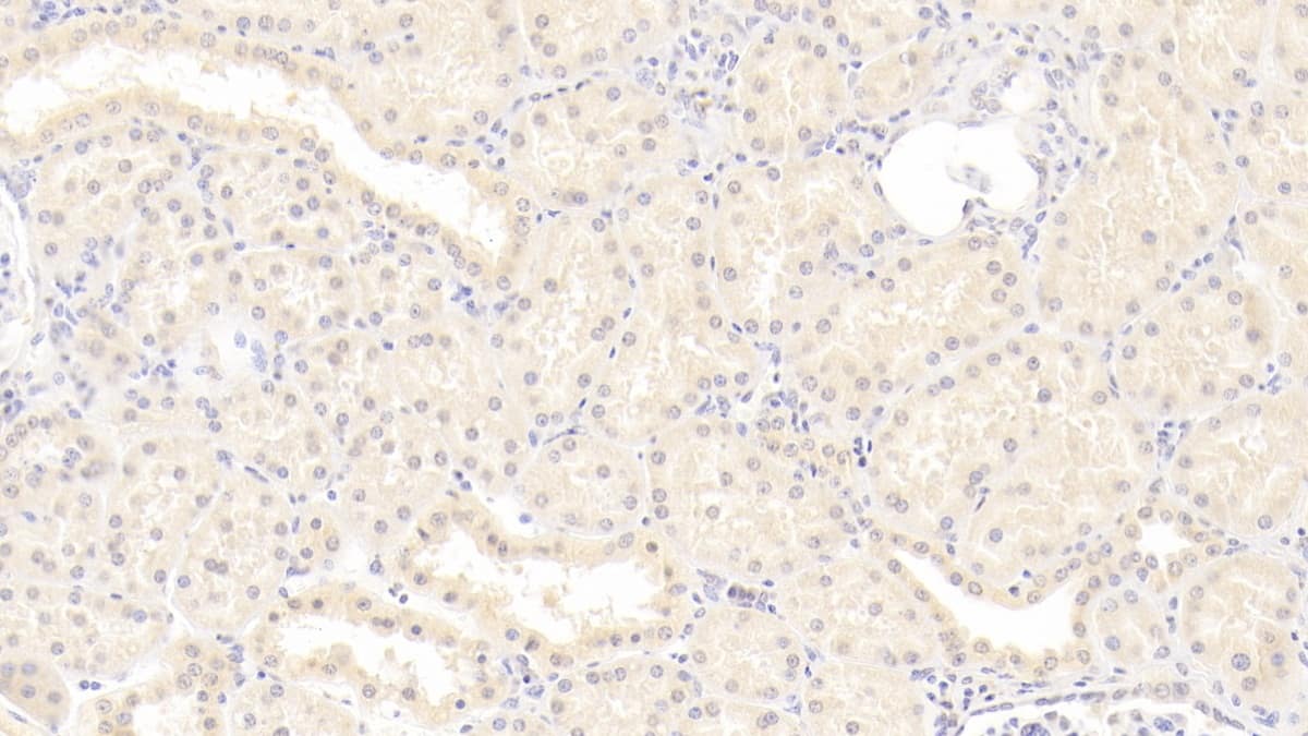 Immunohistochemistry-Paraffin: ISLR Antibody (C9) [NBP3-41936] - DAB staining on IHC-P; Sample: Human Kidney Tissue; Primary Ab: 20ug/ml NBP3-41936; Second Ab: 2ug/mL HRP-Linked Caprine Anti-Mouse IgG Polyclonal Antibody