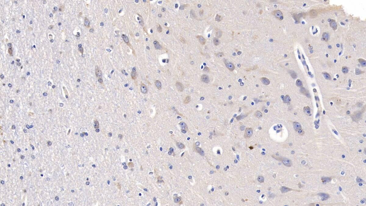 Immunohistochemistry-Paraffin: NMDA R, NR2B Subunit Antibody (D1) [NBP3-41937] - DAB staining on IHC-P; Sample: Human Cerebrum Tissue; Primary Ab: 10ug/ml NBP3-41937; Second Ab: 2ug/mL HRP-Linked Caprine Anti-Mouse IgG Polyclonal Antibody