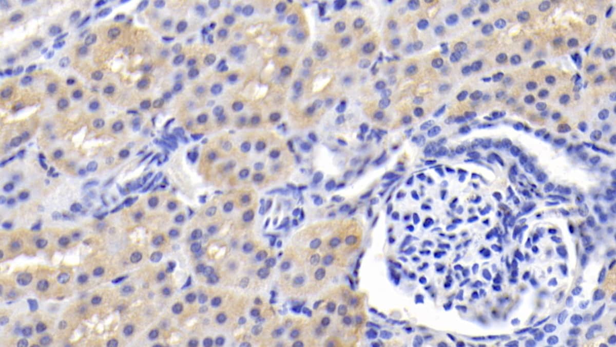 Immunohistochemistry-Paraffin: BAI3 Antibody (C3) [NBP3-41941] - DAB staining on IHC-P; Sample: Human Kidney Tissue; Primary Ab: 20ug/ml NBP3-41941; Second Ab: 2ug/mL HRP-Linked Caprine Anti-Mouse IgG Polyclonal Antibody