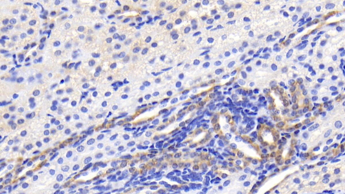 Immunohistochemistry-Paraffin: BAI3 Antibody (C2) [NBP3-41942] - DAB staining on IHC-P; Sample: Human Kidney Tissue; Primary Ab: 20ug/ml NBP3-41942; Second Ab: 2ug/mL HRP-Linked Caprine Anti-Mouse IgG Polyclonal Antibody