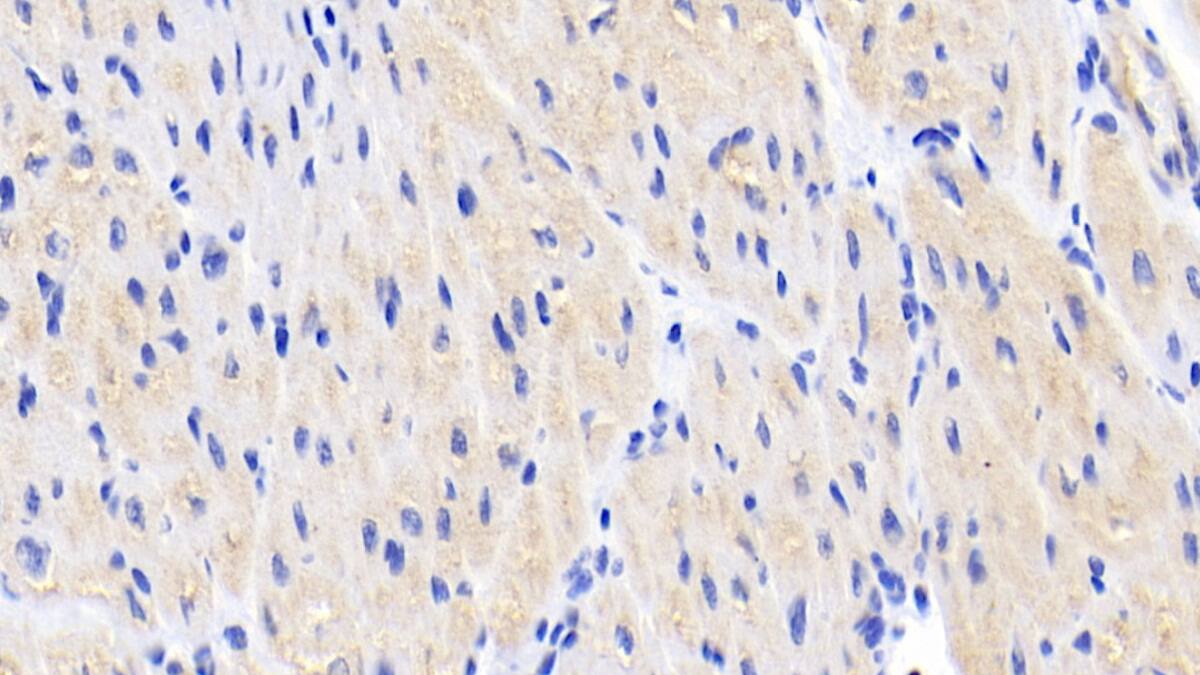 Immunohistochemistry-Paraffin: BAI3 Antibody (C2) [NBP3-41942] - DAB staining on IHC-P; Sample: Human Cardiac Muscle Tissue; Primary Ab: 20ug/ml NBP3-41942; Second Ab: 2ug/mL HRP-Linked Caprine Anti-Mouse IgG Polyclonal Antibody