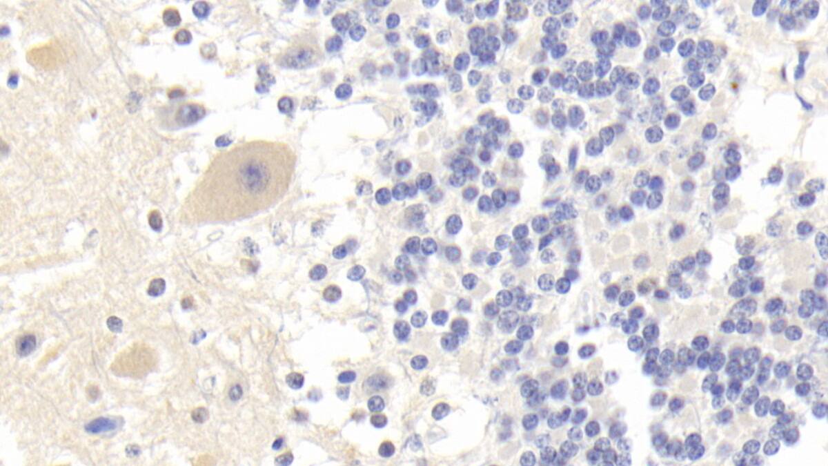 Immunohistochemistry-Paraffin: BAI3 Antibody (C1) [NBP3-41943] - DAB staining on IHC-P; Sample: Human Cerebellum Tissue; Primary Ab: 20ug/ml NBP3-41943; Second Ab: 2ug/mL HRP-Linked Caprine Anti-Mouse IgG Polyclonal Antibody