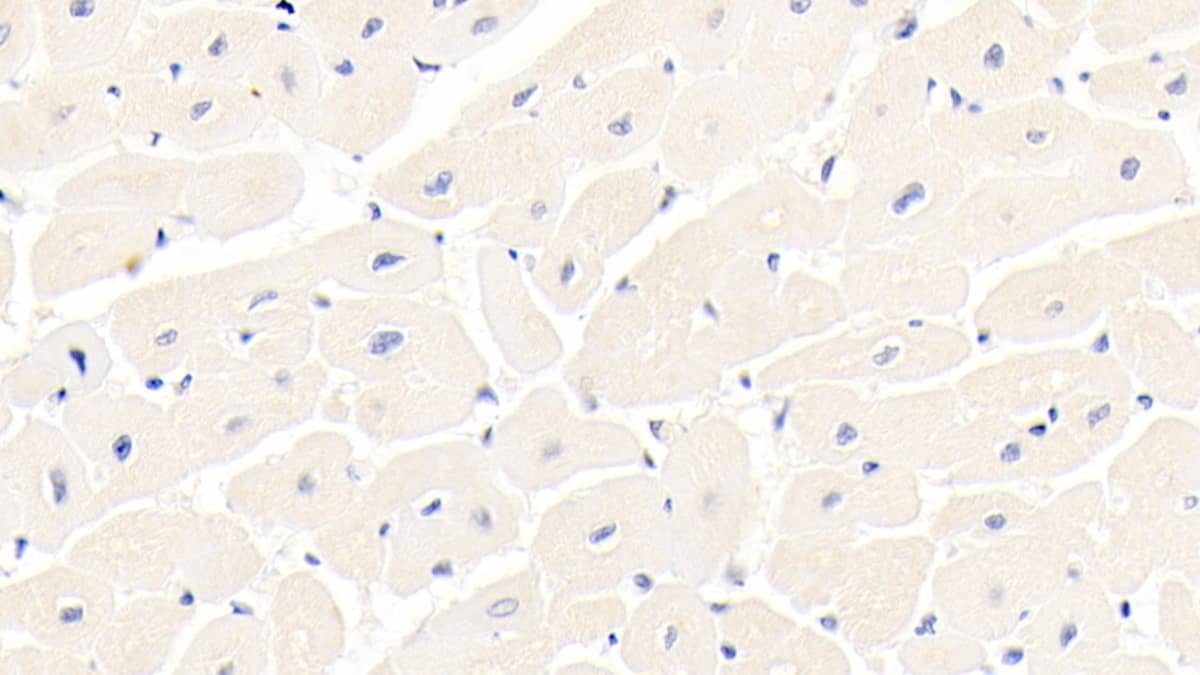 Immunohistochemistry-Paraffin: Integrin alpha 11 Antibody (C3) [NBP3-41945] - DAB staining on IHC-P; Sample: Human Cardiac Muscle Tissue; Primary Ab: 30ug/ml NBP3-41945; Second Ab: 2ug/mL HRP-Linked Caprine Anti-Mouse IgG Polyclonal Antibody