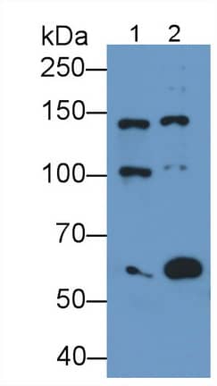 Western Blot NMDAR2D Antibody (D5)