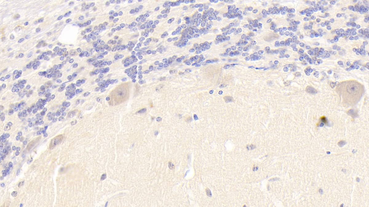 Immunohistochemistry-Paraffin: Phospholipase B1 Antibody (C4) [NBP3-41952] - DAB staining on IHC-P; Sample: Human Cerebellum Tissue; Primary Ab: 20ug/ml NBP3-41952; Second Ab: 2ug/mL HRP-Linked Caprine Anti-Mouse IgG Polyclonal Antibody