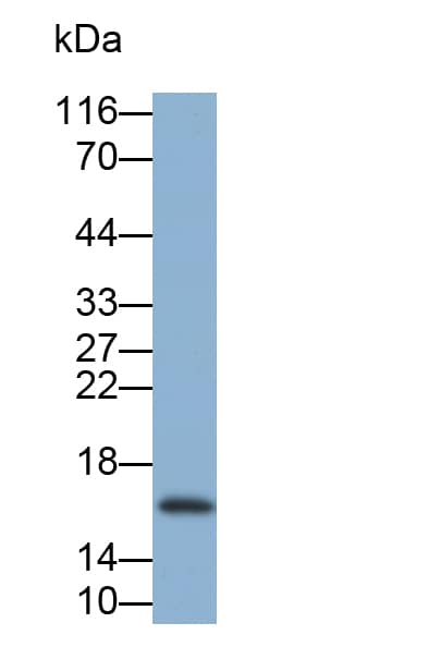 Western Blot: Cystatin SN Antibody (C1) [NBP3-41953] - Sample: Human Saliva Primary Ab: 0.2ug/ml NBP3-41953; Second Ab: 0.2ug/mL HRP-Linked Caprine Anti-Mouse IgG Polyclonal Antibody