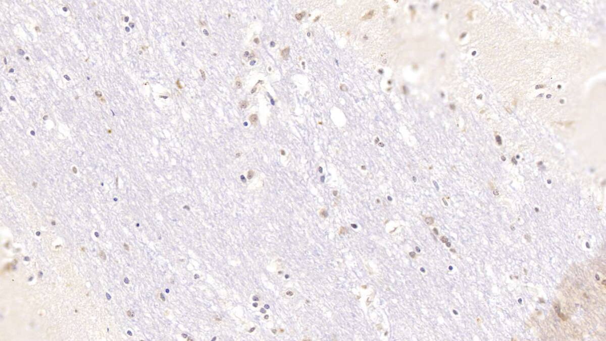 Immunohistochemistry-Paraffin: Serpin A10/ZPI Antibody (C10) [NBP3-41958] - DAB staining on IHC-P; Samples: Human Cerebrum Tissue; Primary Ab: 10ug/ml NBP3-41958; Second Ab: 2ug/mL HRP-Linked Caprine Anti-Mouse IgG Polyclonal Antibody
