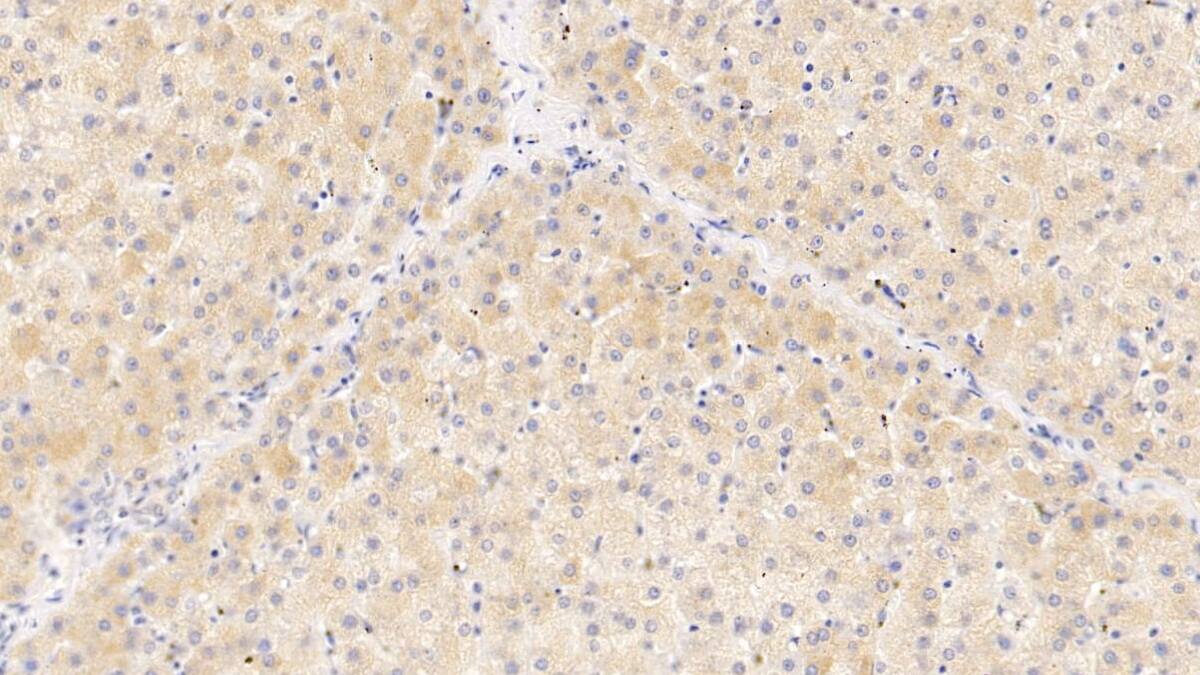 Immunohistochemistry-Paraffin: Serpin A10/ZPI Antibody (C10) [NBP3-41958] - DAB staining on IHC-P; Samples: Human Liver Tissue; Primary Ab: 10ug/ml NBP3-41958; Second Ab: 2ug/mL HRP-Linked Caprine Anti-Mouse IgG Polyclonal Antibody