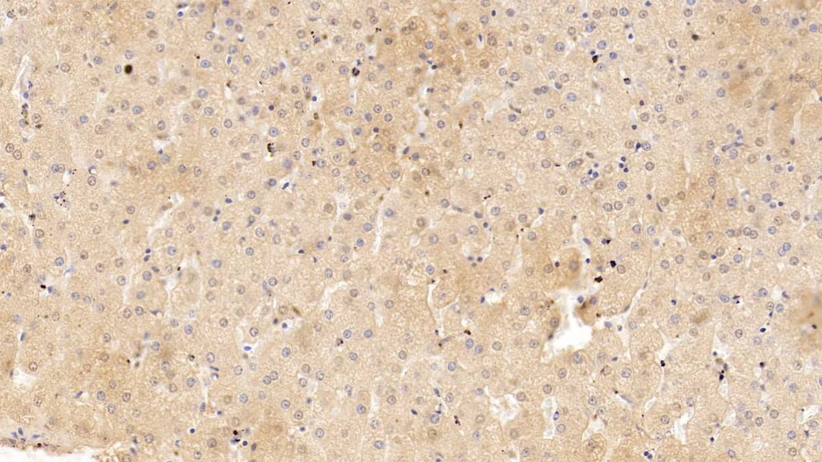 Immunohistochemistry-Paraffin: Serpin A10/ZPI Antibody (C5) [NBP3-41959] - DAB staining on IHC-P; Sample: Human Liver Tissue; Primary Ab: 10ug/ml NBP3-41959; Second Ab: 2ug/mL HRP-Linked Caprine Anti-Mouse IgG Polyclonal Antibody