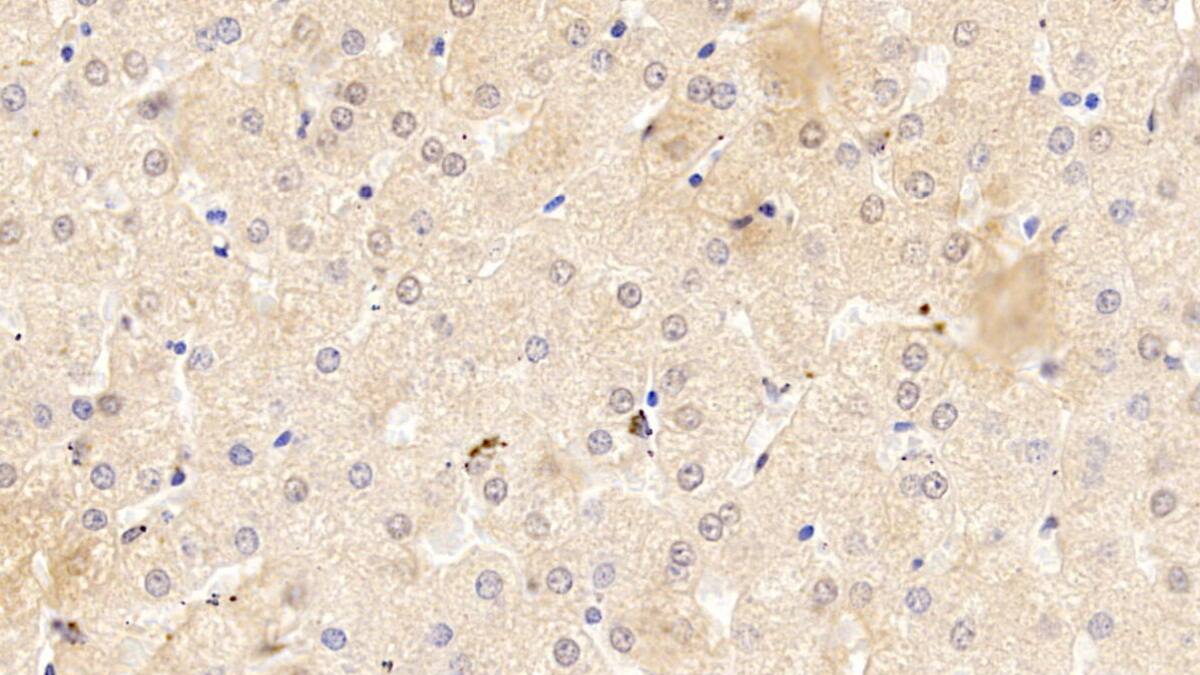 Immunohistochemistry-Paraffin: Serpin A10/ZPI Antibody (C12) [NBP3-41960] - DAB staining on IHC-P; Sample: Human Liver Tissue; Primary Ab: 10ug/ml NBP3-41960; Second Ab: 2ug/mL HRP-Linked Caprine Anti-Mouse IgG Polyclonal Antibody