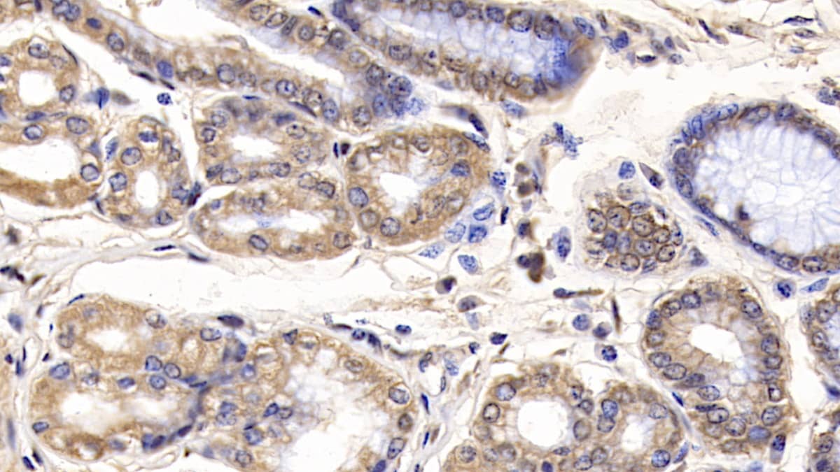 Immunohistochemistry-Paraffin: IL-29/IFN-lambda 1 Antibody (C11) [NBP3-41961] - DAB staining on IHC-P; Sample: Human Stomach Tissue; Primary Ab: 40ug/ml NBP3-41961; Second Ab: 2ug/mL HRP-Linked Caprine Anti-Mouse IgG Polyclonal Antibody