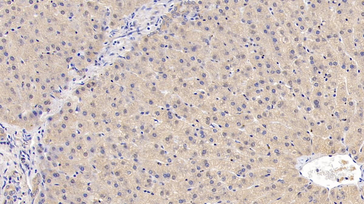 Immunohistochemistry-Paraffin: IL-29/IFN-lambda 1 Antibody (C11) [NBP3-41961] - DAB staining on IHC-P; Sample: Human Liver Tissue; Primary Ab: 40ug/ml NBP3-41961; Second Ab: 2ug/mL HRP-Linked Caprine Anti-Mouse IgG Polyclonal Antibody