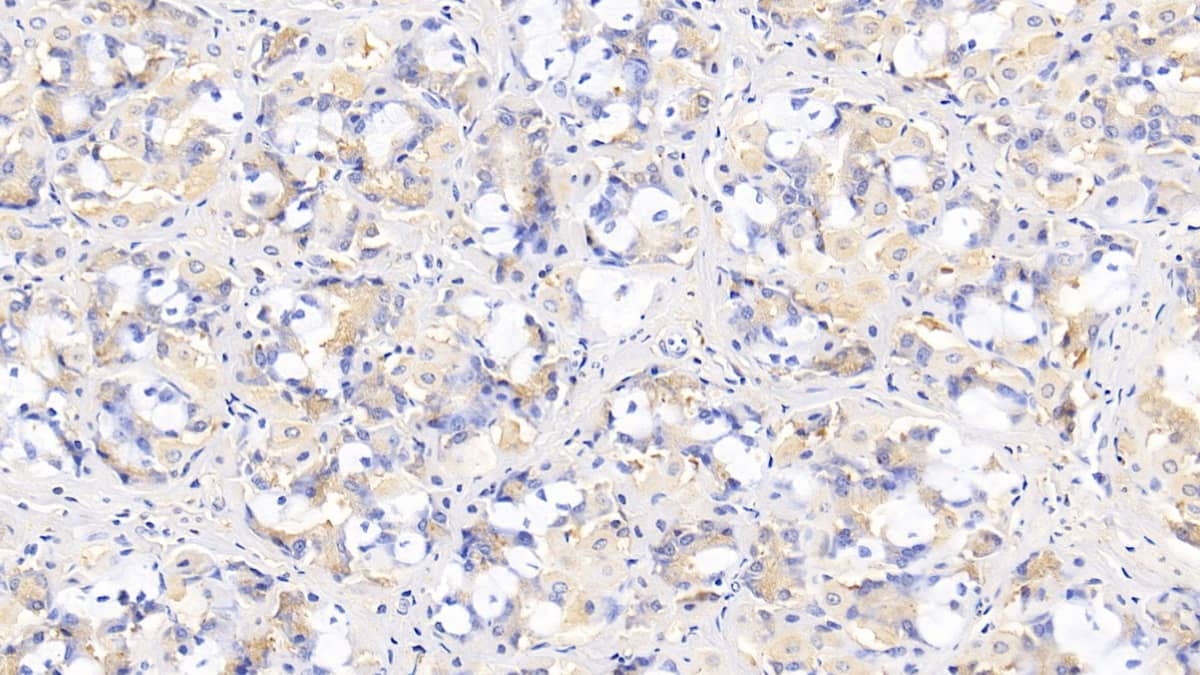 Immunohistochemistry-Paraffin: IL-29/IFN-lambda 1 Antibody (C1) [NBP3-41962] - DAB staining on IHC-P; Sample: Human Stomach Tissue; Primary Ab: 30ug/ml NBP3-41962; Second Ab: 2ug/mL HRP-Linked Caprine Anti-Mouse IgG Polyclonal Antibody