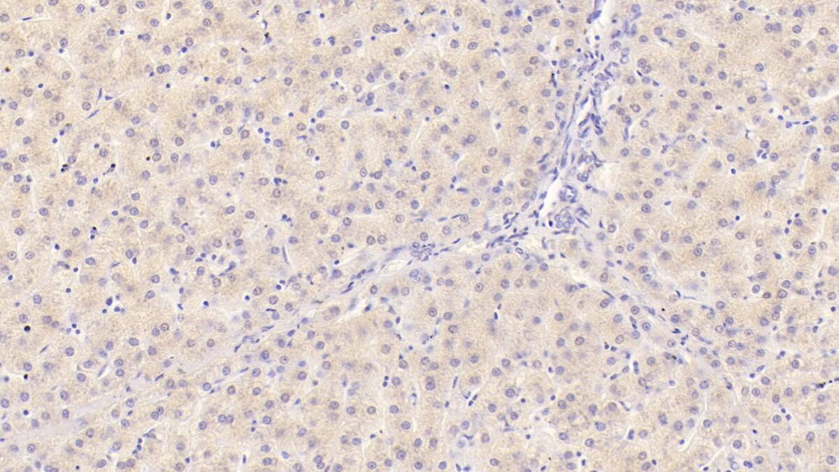 Immunohistochemistry-Paraffin: IL-29/IFN-lambda 1 Antibody (C4) [NBP3-41963] - DAB staining on IHC-P; Sample: Human Liver Tissue; Primary Ab: 30ug/ml NBP3-41963; Second Ab: 2ug/mL HRP-Linked Caprine Anti-Mouse IgG Polyclonal Antibody