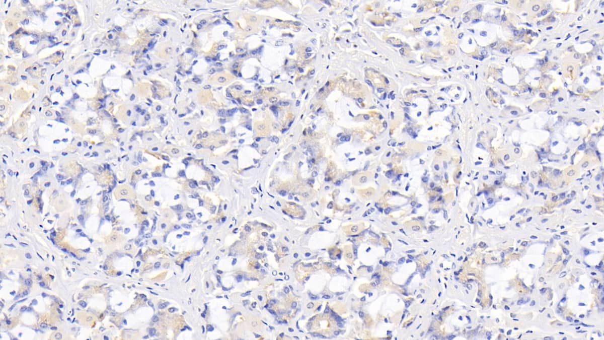 Immunohistochemistry-Paraffin: IL-29/IFN-lambda 1 Antibody (C5) [NBP3-41964] - DAB staining on IHC-P; Sample: Human Stomach Tissue; Primary Ab: 30ug/ml NBP3-41964; Second Ab: 2ug/mL HRP-Linked Caprine Anti-Mouse IgG Polyclonal Antibody