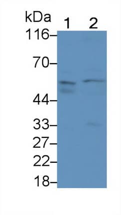 Western Blot: Activin RIIA Antibody (C5) [NBP3-41965] - Sample: Lane1: Rat Testis lysate; Lane2: HepG2 cell lysate Primary Ab: 2ug/ml NBP3-41965; Second Ab: 0.2ug/mL HRP-Linked Caprine Anti-Mouse IgG Polyclonal Antibody